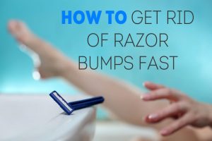 how to get rid of razor bumps fast and easy