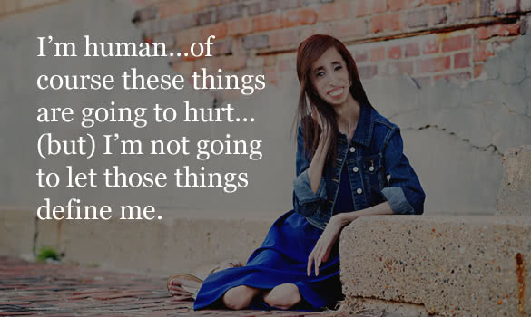im human of course these things are going to hurt but im not going to let those things define me