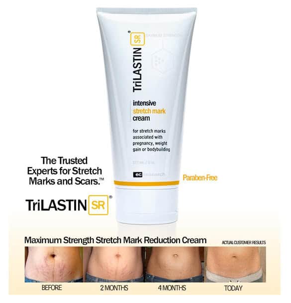 TriLastin-SR Maximum Strength Stretch Mark Cream