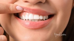 Top 10 Tips for Health Of Your Teeth And Gums