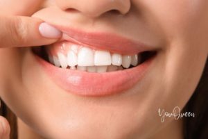 Top 10 Tips for Health Of Your Teeth And Gums